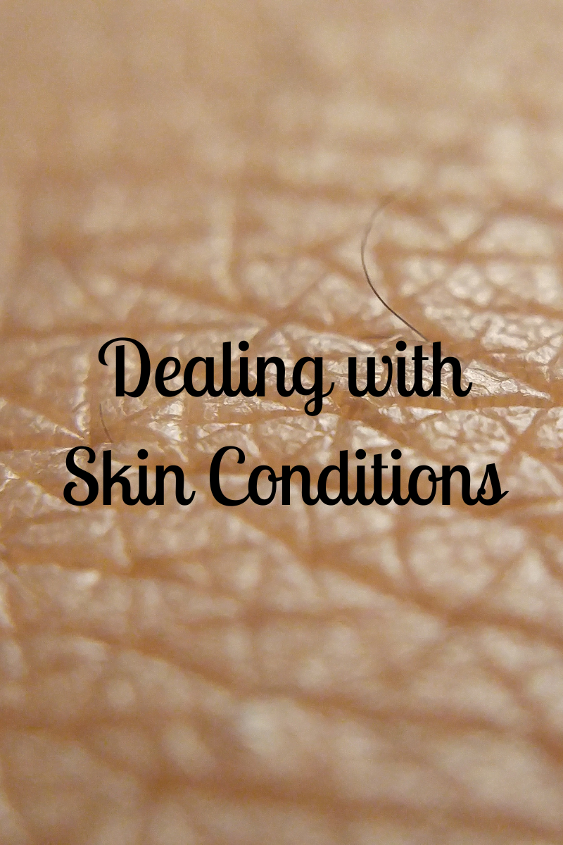 Dealing With Skin Conditions